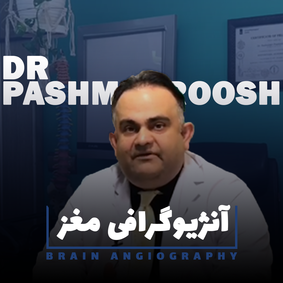 آنژیوگرافی مغز