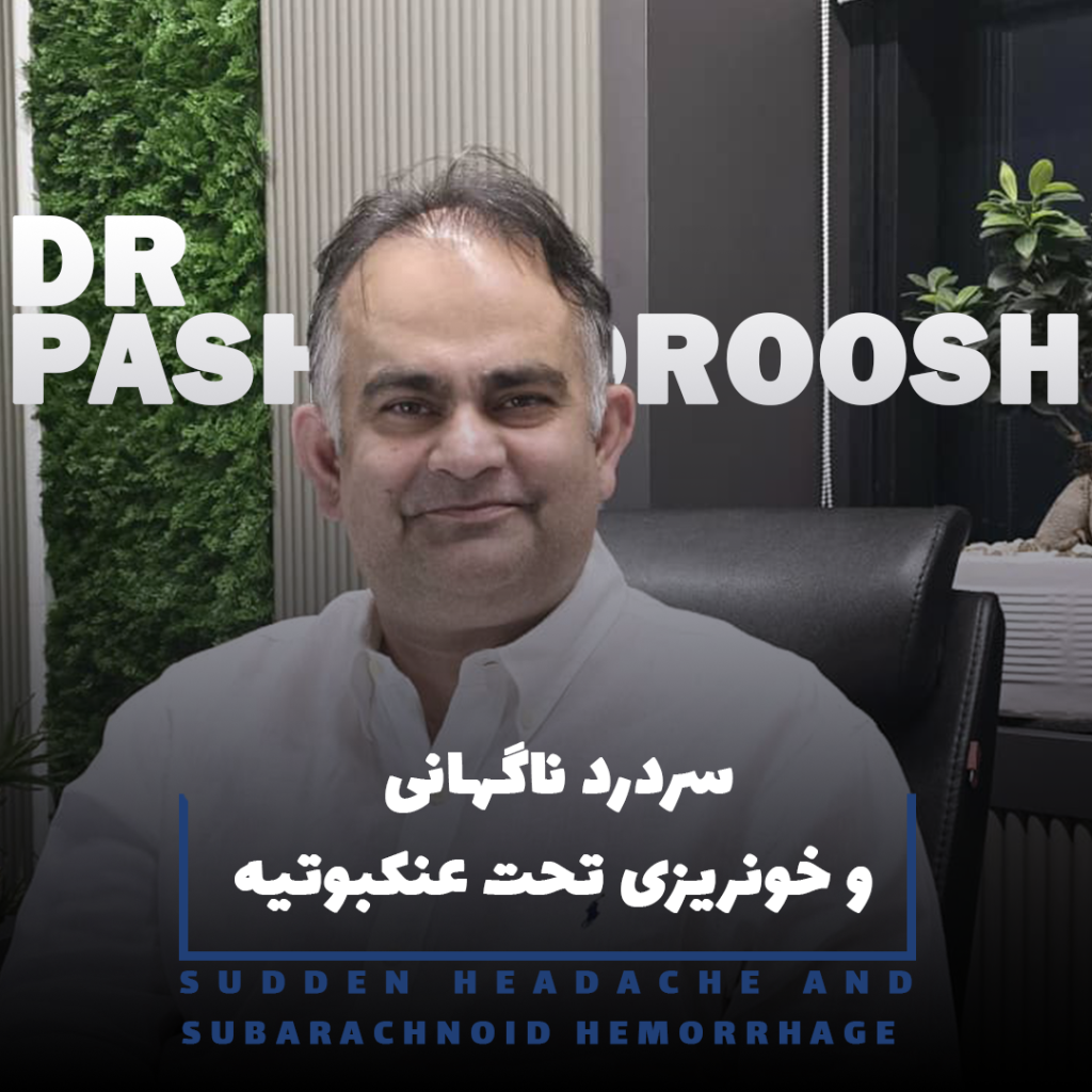 سردرد ناگهانی