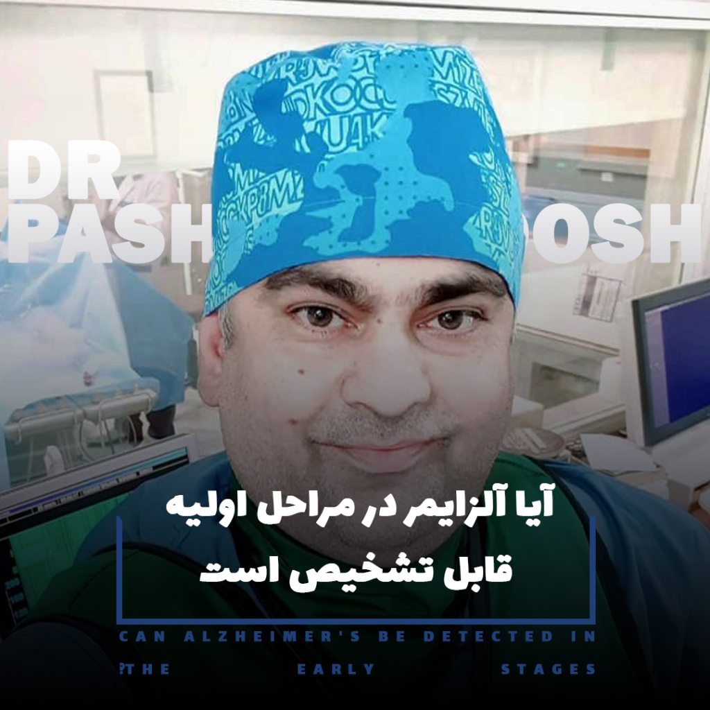 تشخیص زودهنگام آلزایمر