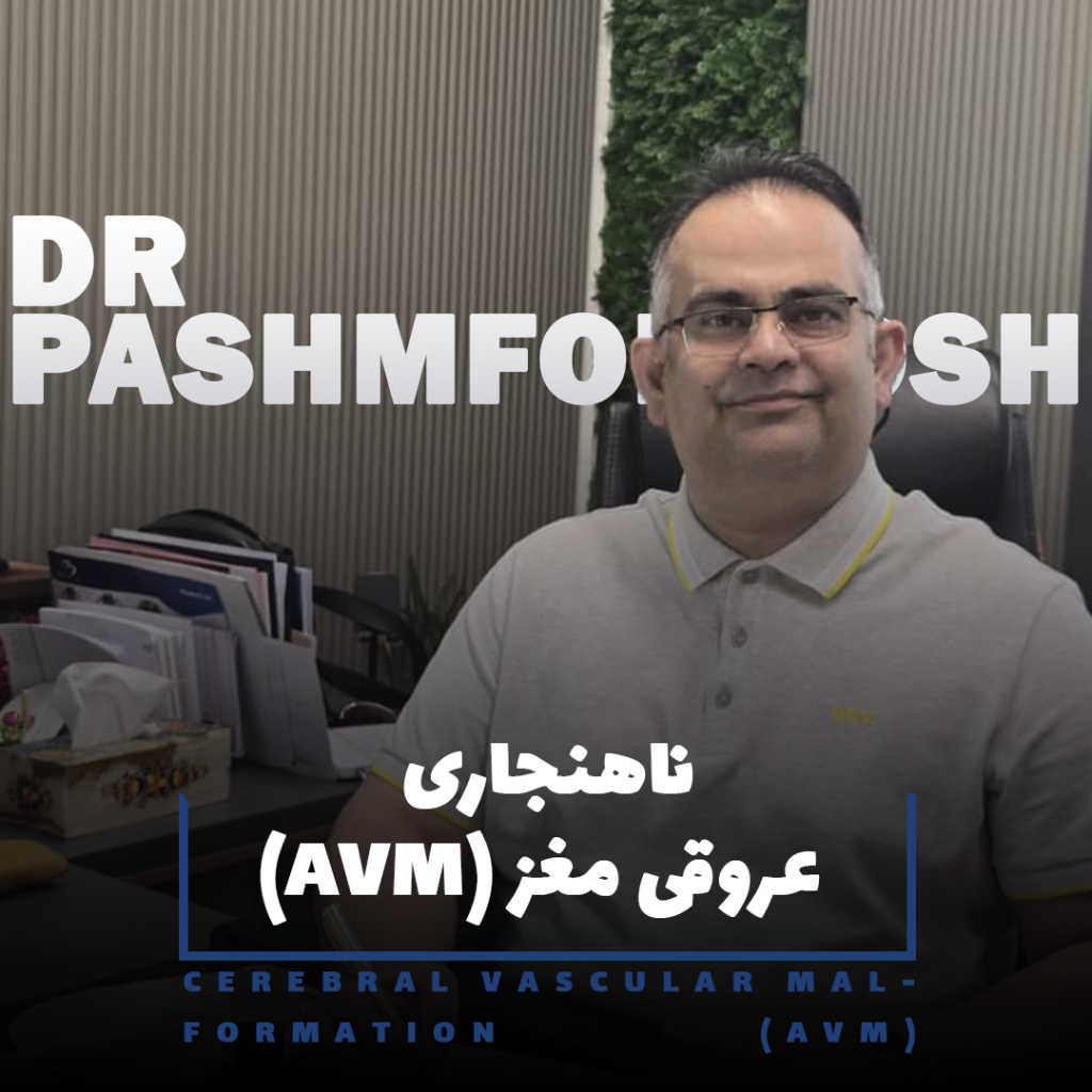 ناهنجاری عروقی مغز (AVM)