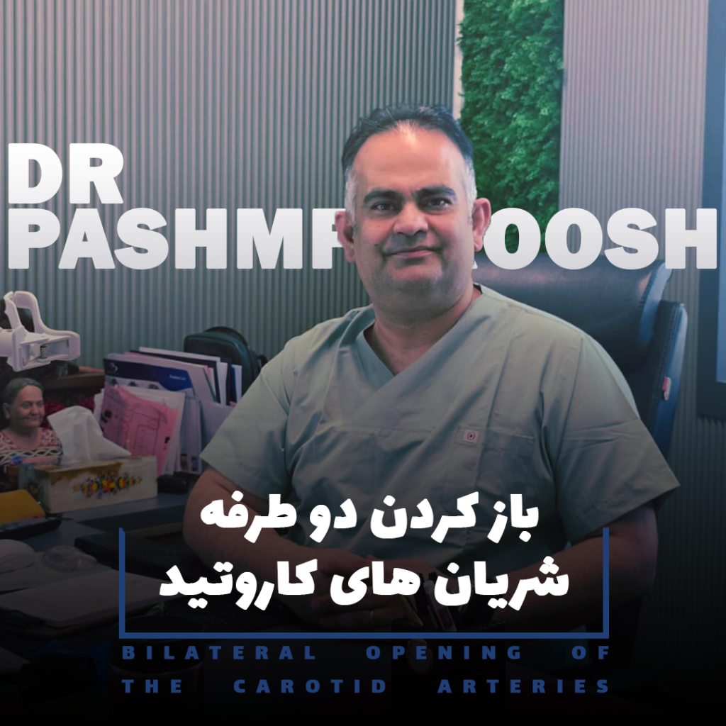 باز کردن دوطرفه شریان‌های کاروتید