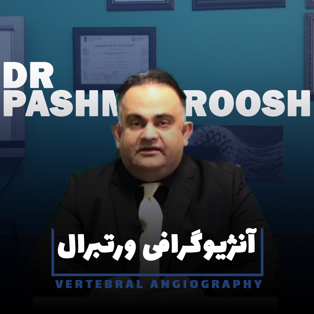 آنژیوگرافی ورتبرال