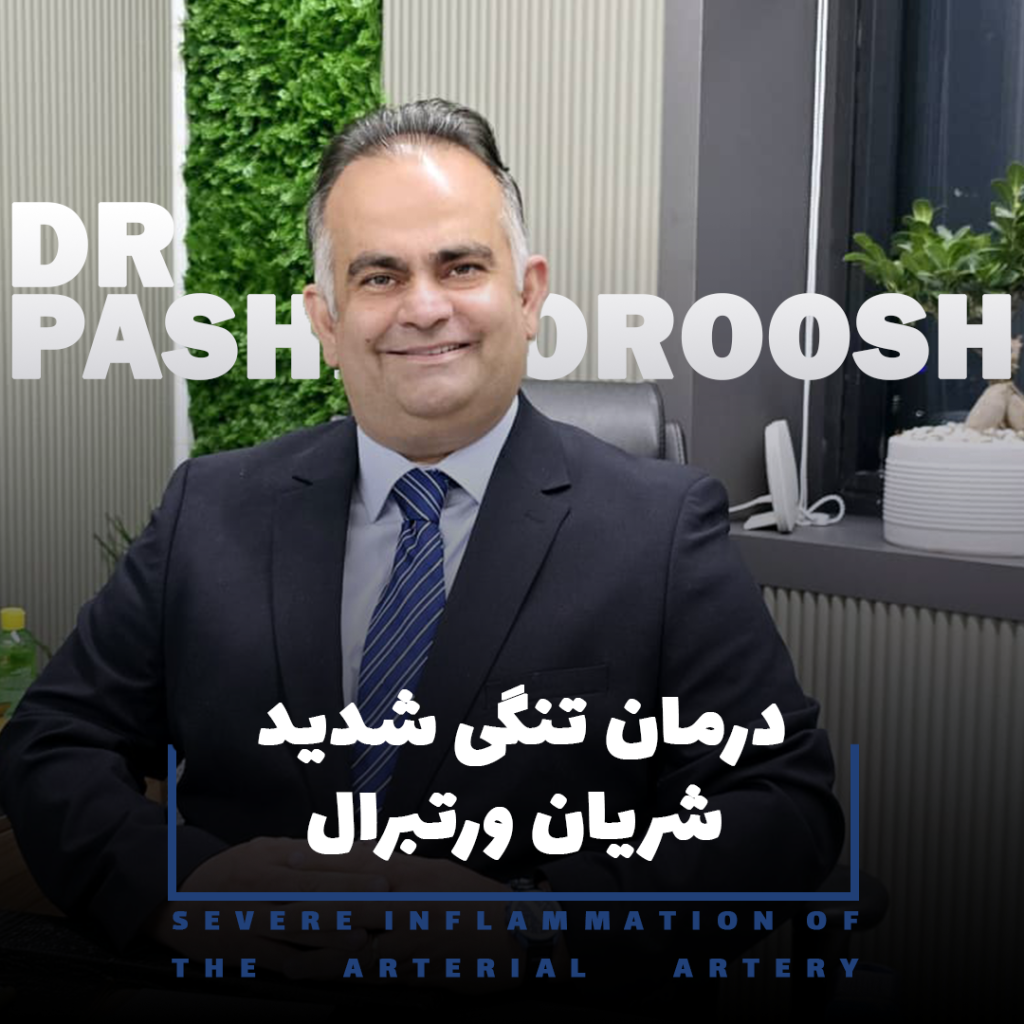 درمان تنگی شدید