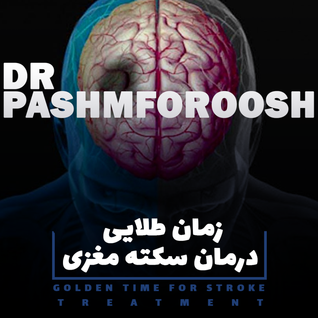 زمان طلایی درمان سکته مغزی | تشخیص سریع و اقدام فوری