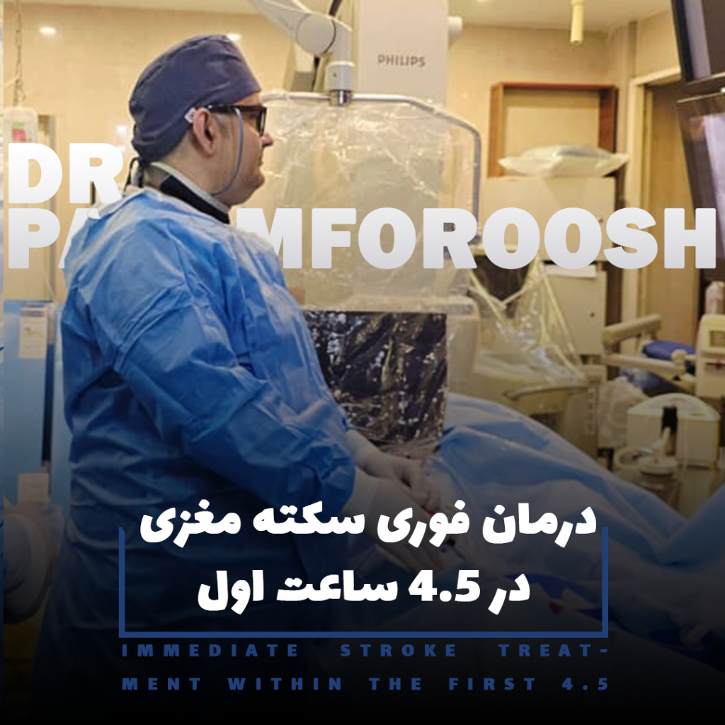 درمان فوری سکته مغزی