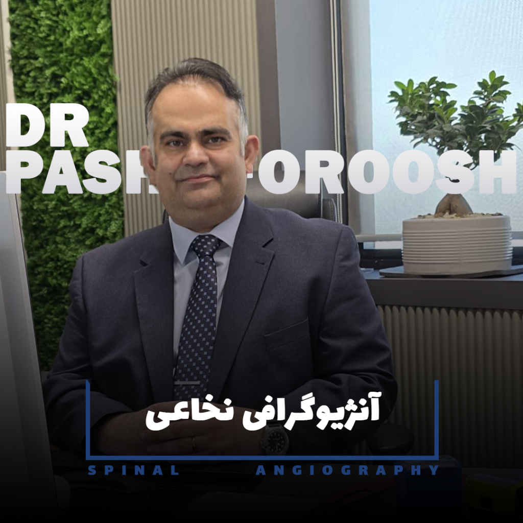 آنژیوگرافی نخاعی
