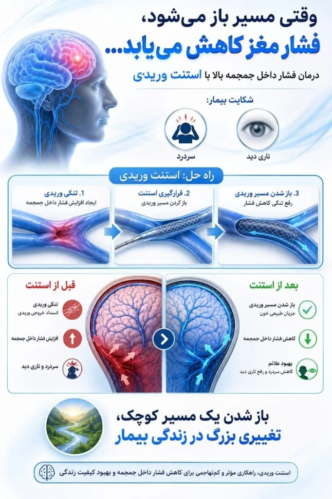 اینفوگرافیک درمان فشار داخل جمجمه بالا با استنت وریدی؛ مقایسه وضعیت قبل و بعد از استنت‌گذاری