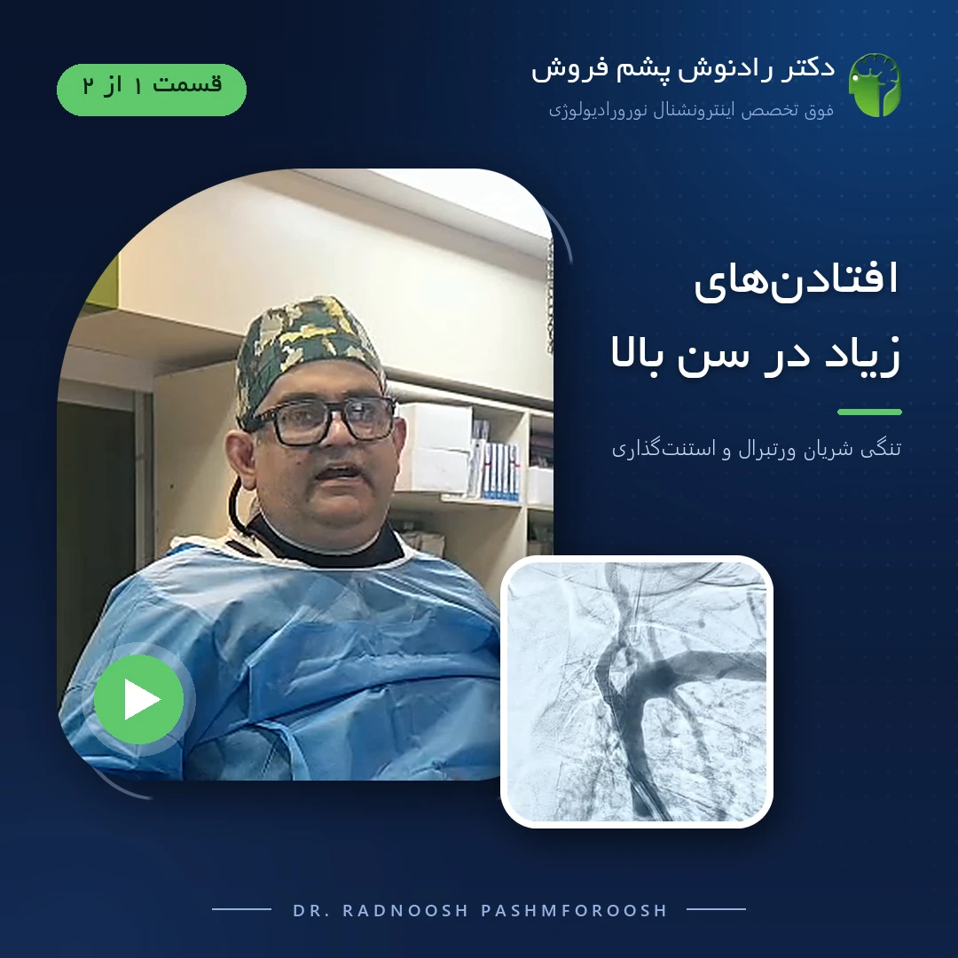 دکتر رادنوش پشم فروش در اتاق آنژیوگرافی، کنار تصویر آنژیوگرافی شریان ورتبرال؛ جلد ویدیوی افتادن‌های زیاد در سن بالا، قسمت ۱