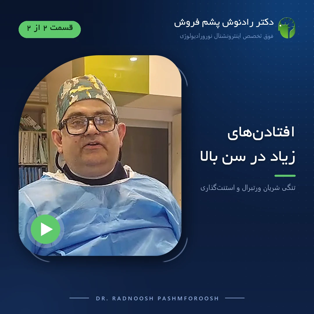 دکتر رادنوش پشم فروش در اتاق آنژیوگرافی؛ جلد ویدیوی افتادن‌های زیاد در سن بالا و تنگی شریان ورتبرال، قسمت ۲