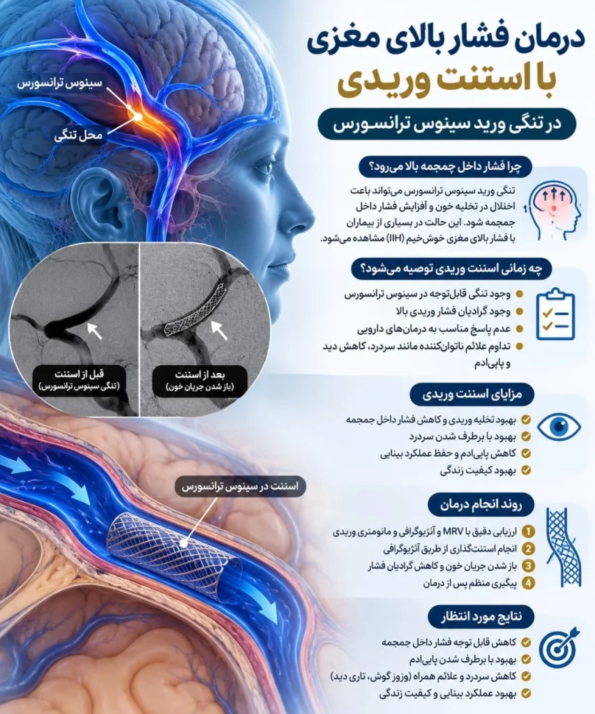 اینفوگرافیک درمان فشار بالای مغزی (IIH) با استنت وریدی در تنگی سینوس ترانسورس، با تصویر قبل و بعد از استنت