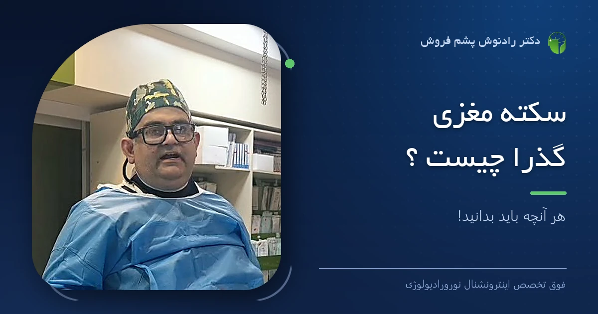 دکتر رادنوش پشم فروش، فوق تخصص اینترونشنال نورورادیولوژی — تصویر شاخص مقاله «سکته مغزی گذرا چیست ؟ | هر آنچه باید بدانید!»