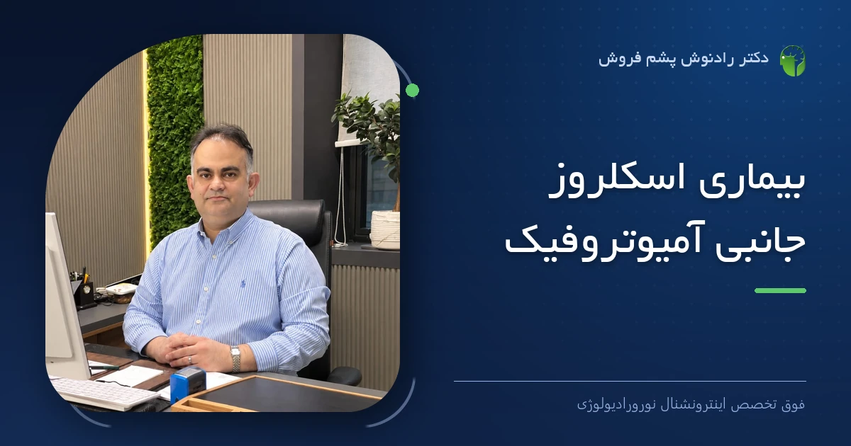 دکتر رادنوش پشم فروش، فوق تخصص اینترونشنال نورورادیولوژی — تصویر شاخص مقاله «بیماری اسکلروز جانبی آمیوتروفیک»