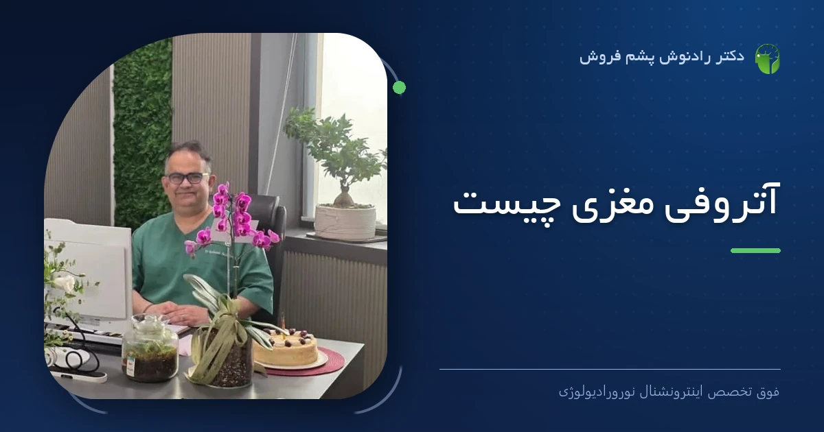 دکتر رادنوش پشم فروش، فوق تخصص اینترونشنال نورورادیولوژی — تصویر شاخص مقاله «آتروفی مغزی چیست»