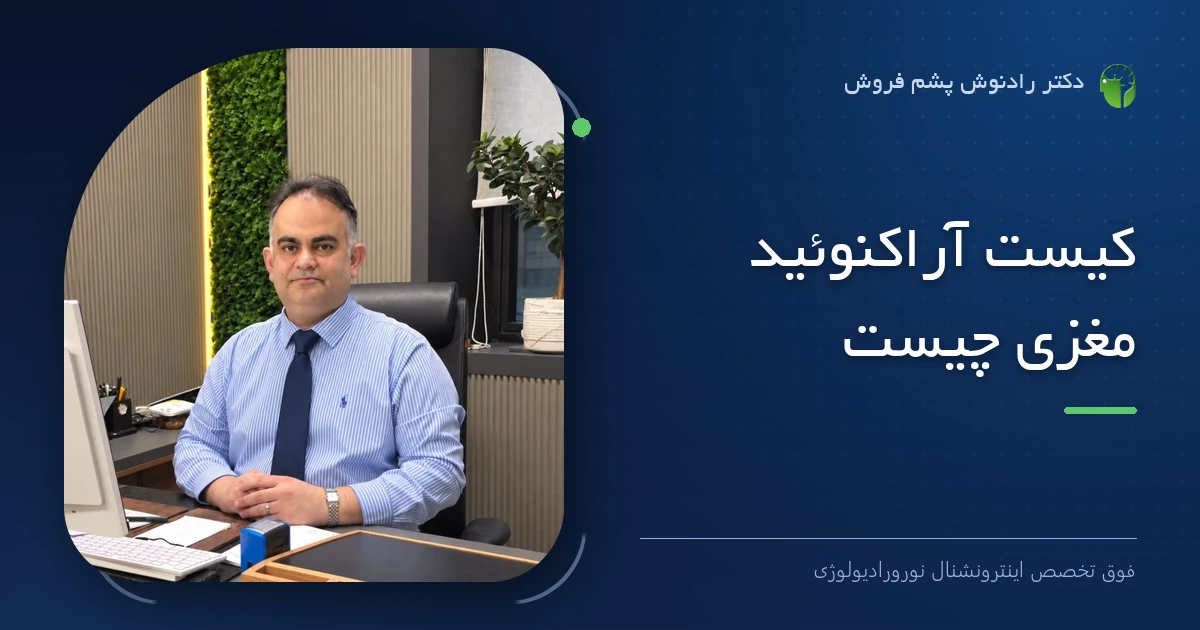 دکتر رادنوش پشم فروش، فوق تخصص اینترونشنال نورورادیولوژی — تصویر شاخص مقاله «کیست آراکنوئید مغزی چیست»
