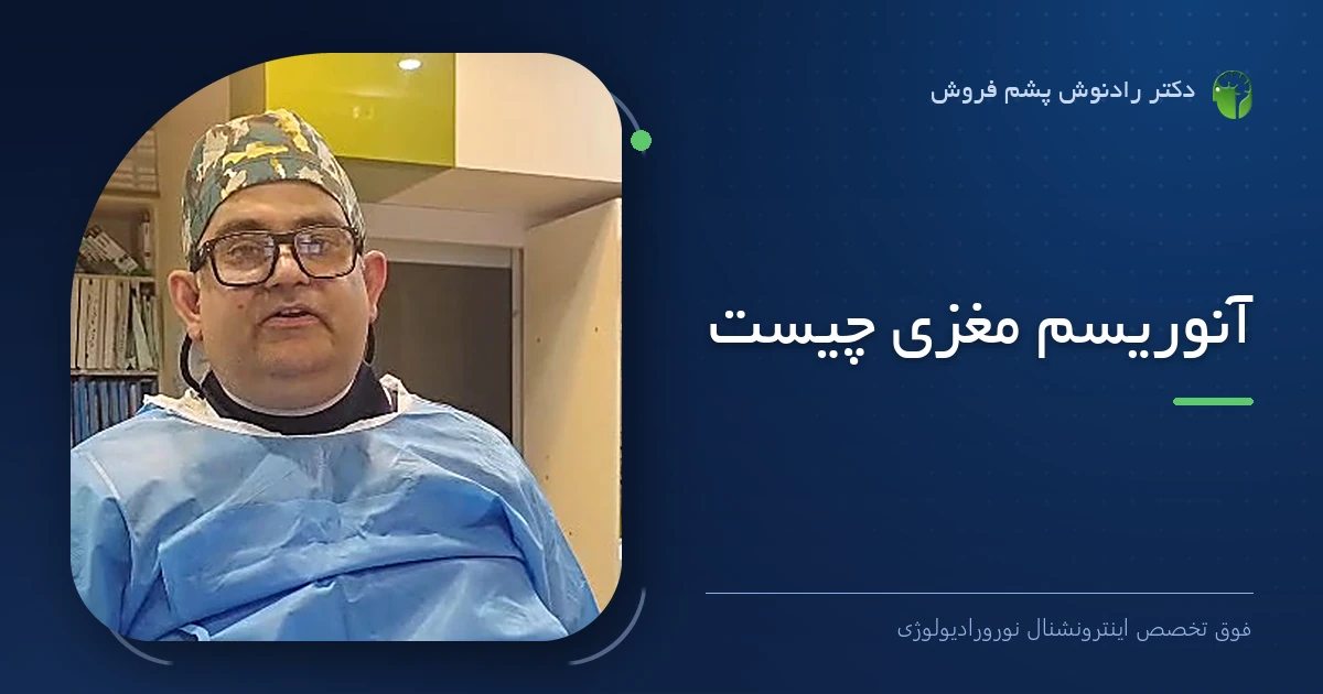 دکتر رادنوش پشم فروش، فوق تخصص اینترونشنال نورورادیولوژی — تصویر شاخص مقاله «آنوریسم مغزی چیست»
