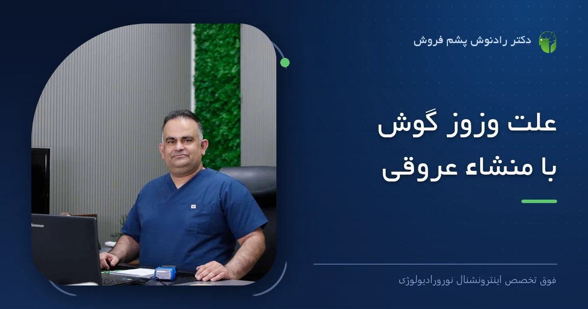 دکتر رادنوش پشم فروش، فوق تخصص اینترونشنال نورورادیولوژی — تصویر شاخص مقاله «علت وزوز گوش با منشاء عروقی»