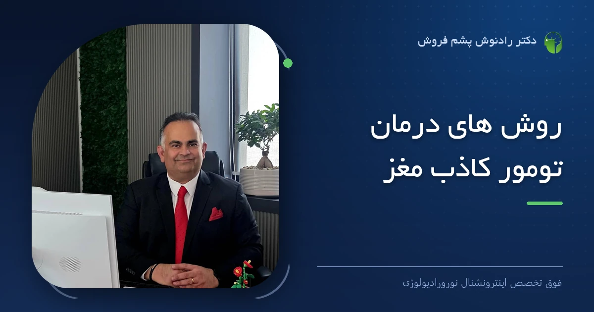 دکتر رادنوش پشم فروش، فوق تخصص اینترونشنال نورورادیولوژی — تصویر شاخص مقاله «روش های درمان تومور کاذب مغز»