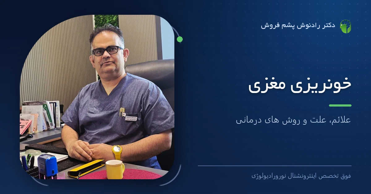 دکتر رادنوش پشم فروش، فوق تخصص اینترونشنال نورورادیولوژی — تصویر شاخص مقاله «خونریزی مغزی | علائم ، علت و روش های درمانی»