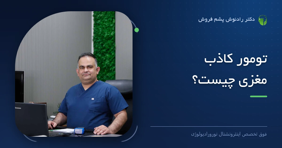 دکتر رادنوش پشم فروش، فوق تخصص اینترونشنال نورورادیولوژی — تصویر شاخص مقاله «تومور کاذب مغزی چیست؟»