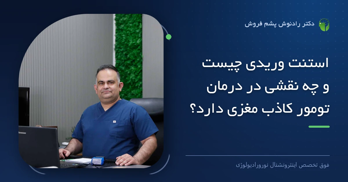 دکتر رادنوش پشم فروش، فوق تخصص اینترونشنال نورورادیولوژی — تصویر شاخص مقاله «استنت وریدی چیست و چه نقشی در درمان تومور کاذب مغزی دارد؟»