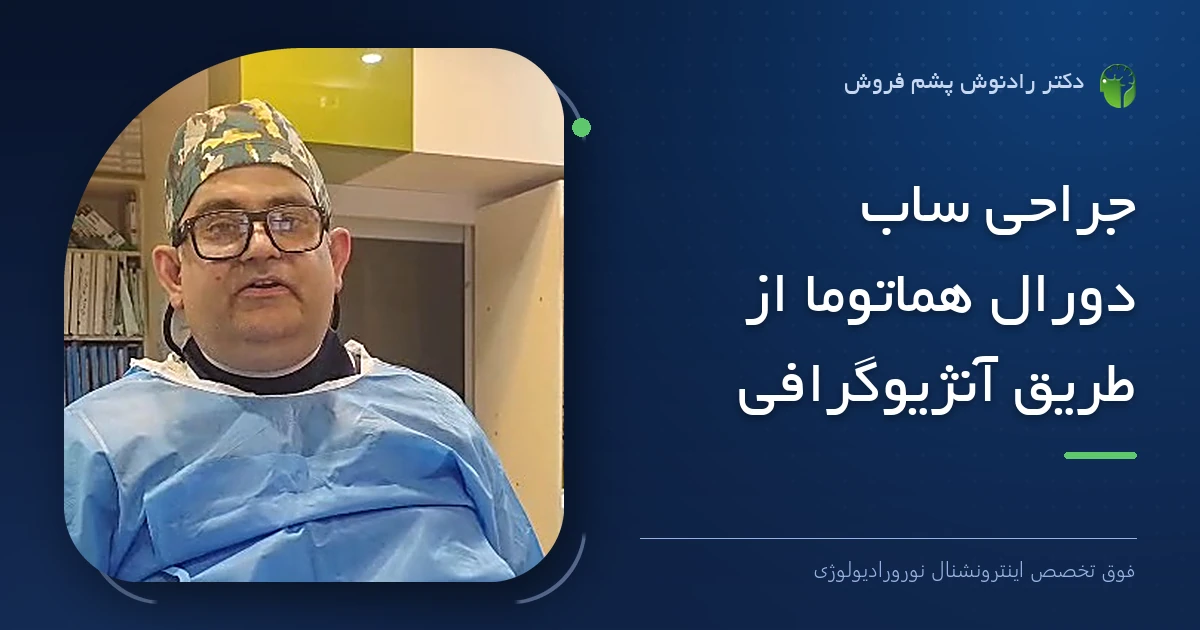 دکتر رادنوش پشم فروش، فوق تخصص اینترونشنال نورورادیولوژی — تصویر شاخص مقاله «جراحی ساب دورال هماتوما از طریق آنژیوگرافی»