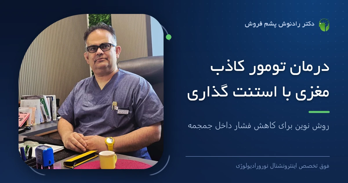 دکتر رادنوش پشم فروش، فوق تخصص اینترونشنال نورورادیولوژی — تصویر شاخص مقاله «درمان تومور کاذب مغزی با استنت گذاری؛ روش نوین برای کاهش فشار داخل جمجمه»