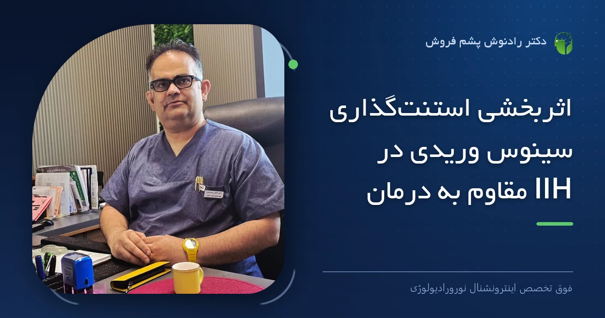 دکتر رادنوش پشم فروش، فوق تخصص اینترونشنال نورورادیولوژی — تصویر شاخص مقاله «اثربخشی استنت‌گذاری سینوس وریدی در IIH مقاوم به درمان»