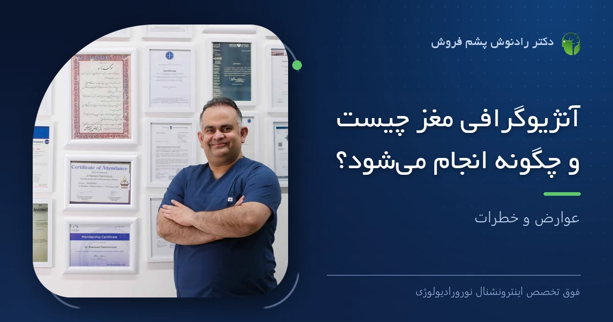 دکتر رادنوش پشم فروش، فوق تخصص اینترونشنال نورورادیولوژی — تصویر شاخص مقاله «آنژیوگرافی مغز چیست و چگونه انجام می‌شود؟ عوارض و خطرات»