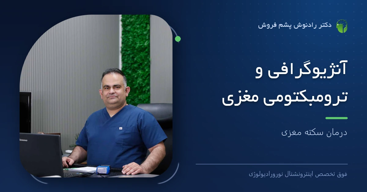 دکتر رادنوش پشم فروش، فوق تخصص اینترونشنال نورورادیولوژی — تصویر شاخص مقاله «آنژیوگرافی و ترومبکتومی مغزی | درمان سکته مغزی»