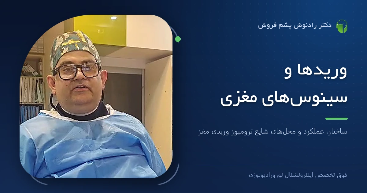 دکتر رادنوش پشم فروش، فوق تخصص اینترونشنال نورورادیولوژی — تصویر شاخص مقاله «وریدها و سینوس‌های مغزی؛ ساختار، عملکرد و محل‌های شایع ترومبوز وریدی مغز»