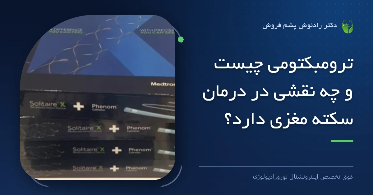 دکتر رادنوش پشم فروش، فوق تخصص اینترونشنال نورورادیولوژی — تصویر شاخص مقاله «ترومبکتومی چیست و چه نقشی در درمان سکته مغزی دارد؟»