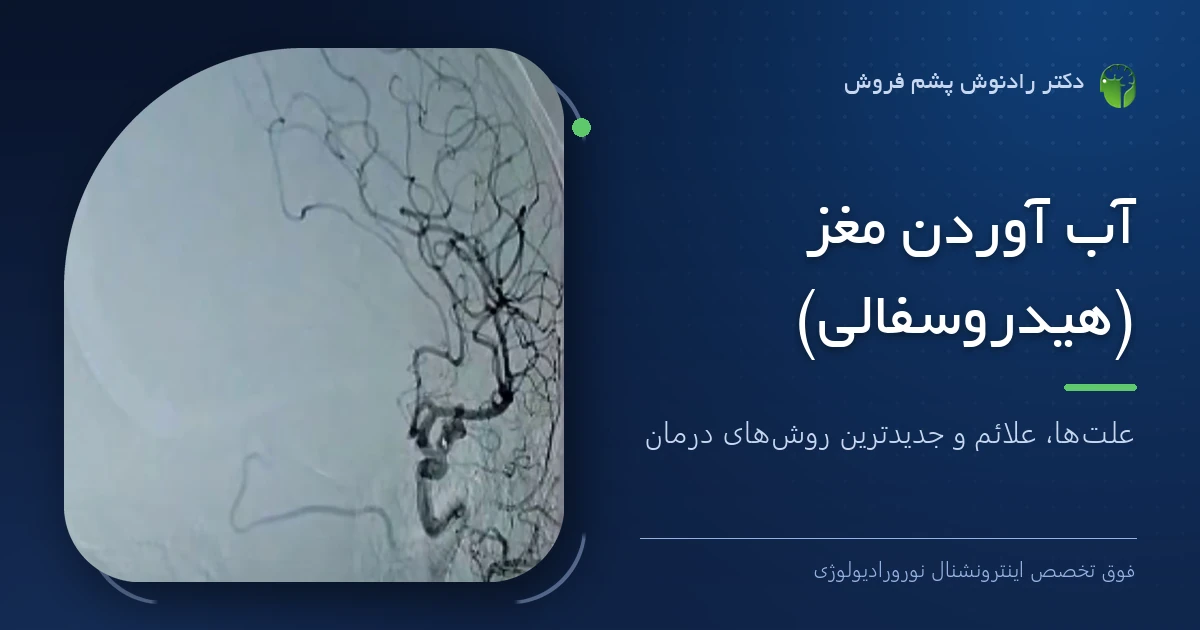 دکتر رادنوش پشم فروش، فوق تخصص اینترونشنال نورورادیولوژی — تصویر شاخص مقاله «آب آوردن مغز (هیدروسفالی) | علت‌ها، علائم و جدیدترین روش‌های درمان»
