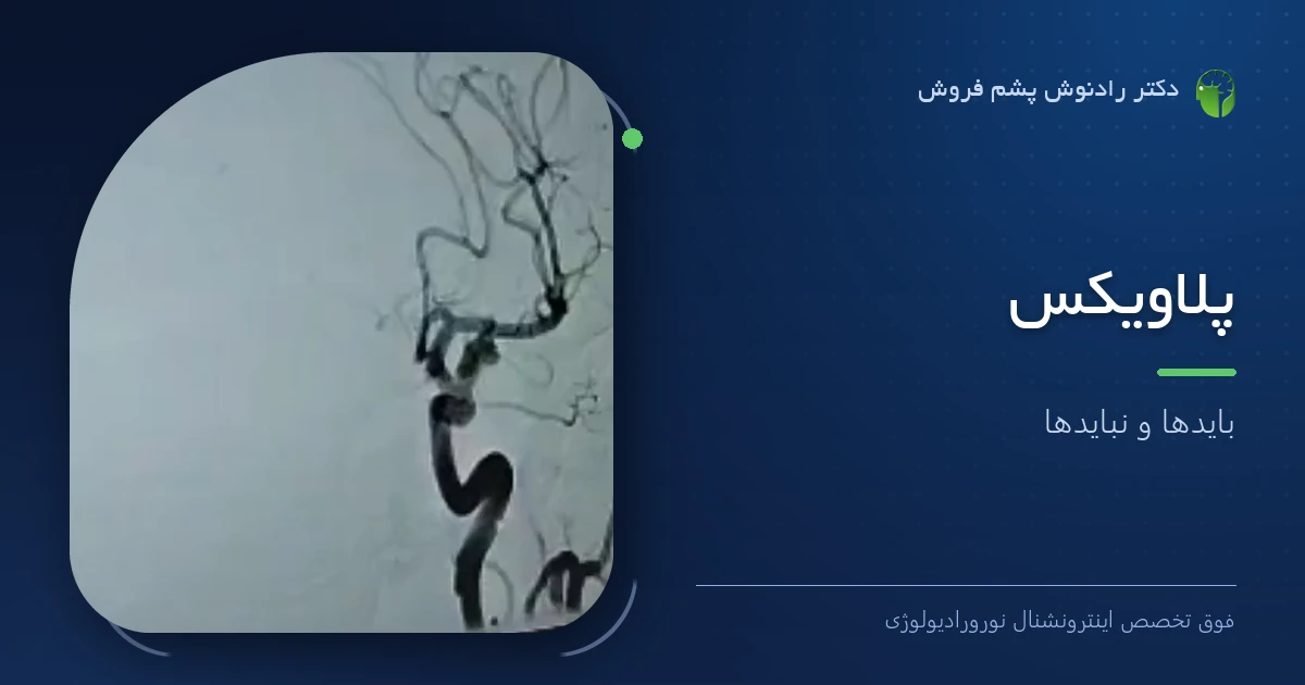 دکتر رادنوش پشم فروش، فوق تخصص اینترونشنال نورورادیولوژی — تصویر شاخص مقاله «پلاویکس؛ بایدها و نبایدها»