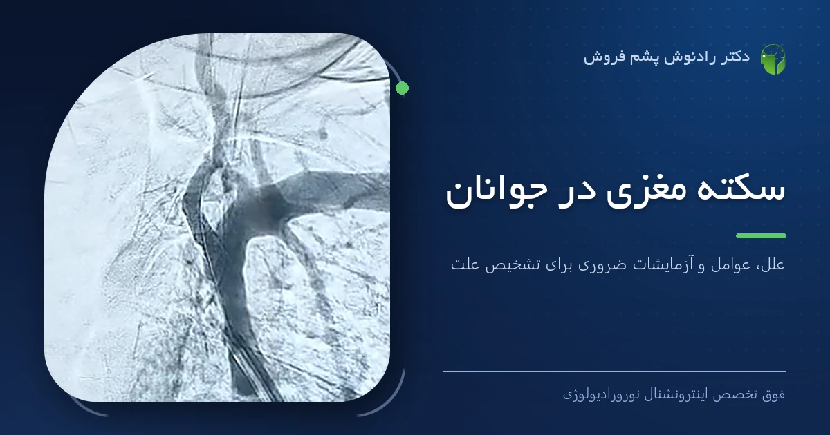 دکتر رادنوش پشم فروش، فوق تخصص اینترونشنال نورورادیولوژی — تصویر شاخص مقاله «سکته مغزی در جوانان؛ علل، عوامل و آزمایشات ضروری برای تشخیص علت»