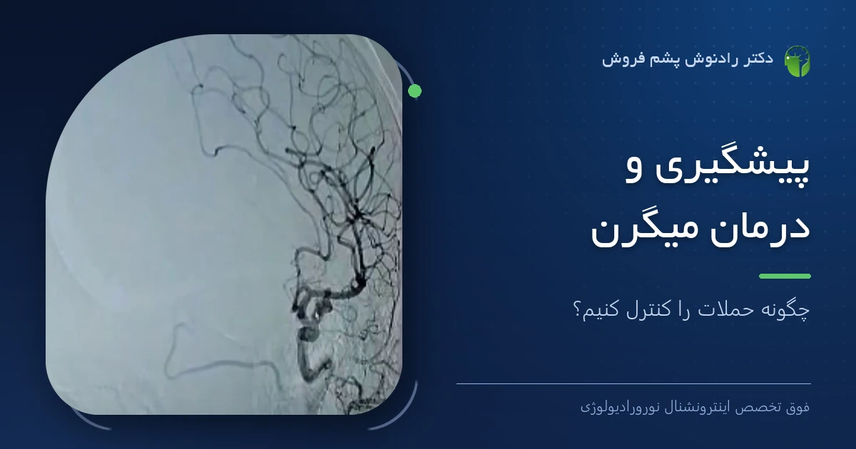 دکتر رادنوش پشم فروش، فوق تخصص اینترونشنال نورورادیولوژی — تصویر شاخص مقاله «پیشگیری و درمان میگرن؛ چگونه حملات را کنترل کنیم؟»