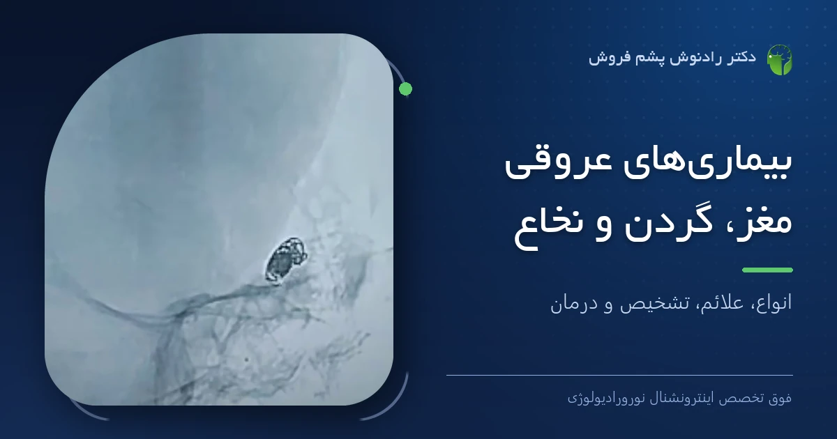 دکتر رادنوش پشم فروش، فوق تخصص اینترونشنال نورورادیولوژی — تصویر شاخص مقاله «بیماری‌های عروقی مغز، گردن و نخاع؛ انواع، علائم، تشخیص و درمان»